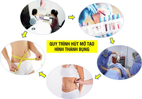 Tìm hiểu phương pháp hút mỡ bụng nội soi tạo hình thành bụng