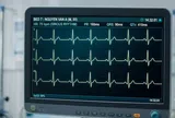 Những thói quen làm tăng nguy cơ rối loạn nhịp tim mà ít người để tâm