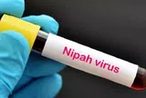 Bangladesh ghi nhận ca tử vong đầu tiên do virus Nipah trong năm 2024