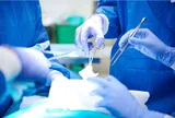 Lỗ tiểu đóng thấp: Nguyên nhân, biểu hiện, cách điều trị và phòng bệnh