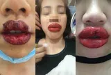 Những điều chị em cần lưu ý trước khi phun xăm môi để tránh rước họa vào thân