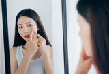 Hành trình giảm mụn trong 1 tháng của cô nàng công sở nhờ chọn đúng loại tẩy trang.