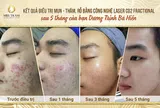Top 6 điều lưu ý khi chăm sóc da tại Spa, Thẩm mỹ viện