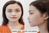 Nhờ nâng mũi phong thủy - Cô nàng 'Ẵm ngay' danh hiệu nữ hoàng quyến rũ