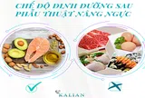 Phẫu thuật thẩm mỹ nâng ngực duy trì được bao lâu?
