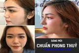 Nâng mũi phong thủy theo góc nhìn từ Ths. Bác sỹ Trần Quang Long
