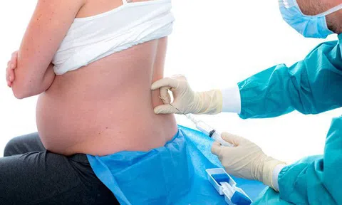 Sử dụng thuốc gây tê giúp sản phụ giảm đau khi sinh con có thể gây biến chứng, tử vong