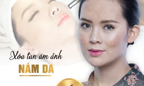 Thẩm mỹ viện quốc tế Bắc Mỹ trị nám uy tín tại Thanh Hóa