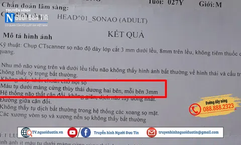 Vụ đánh hội đồng ở khu du lịch Cát Bà, Hải Phòng: Vì sao CA “giấu ”video ở hiện trường?