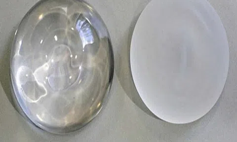 Đặt túi ngực bao nhiêu tiền? Hướng dẫn chọn túi ngực an toàn cho phái đẹp