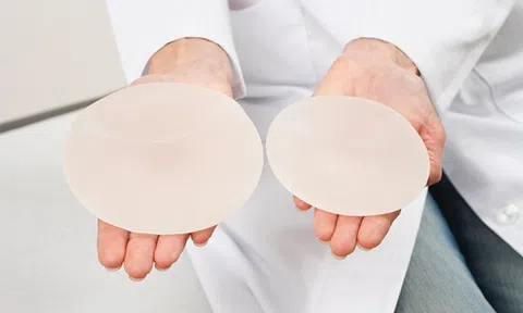 Tư vấn chi tiết về nâng ngực chảy xệ, định hình lại bầu ngực đẹp