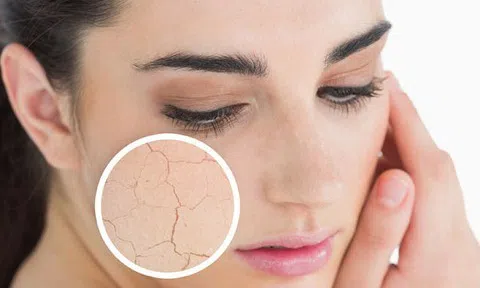 Những nguyên nhân gây khô da và cách khắc phục