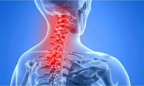 Đau cổ vai gáy có nguy hiểm, khi nào là bệnh lý phải nhập viện?