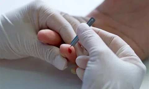 Tuyệt đối không nên làm điều này khi sơ cứu người đột quỵ!