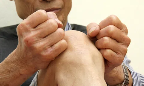 Thoái hóa khớp gối ở người cao tuổi: Cách chăm sóc và phòng ngừa hiệu quả