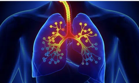 Những nguyên nhân gây phế quản co thắt