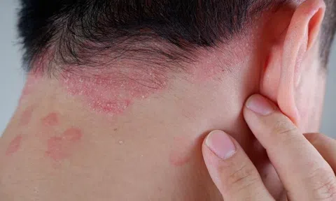 Nguy cơ biến chứng tiêu đường đến từ đâu