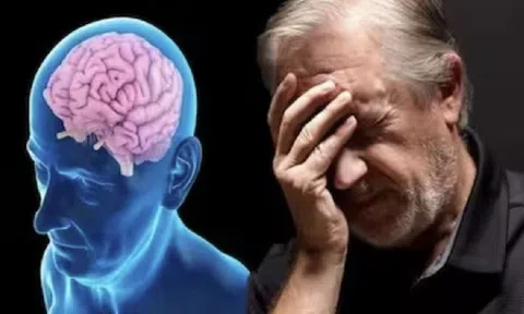 Nhận diện sớm bệnh Alzheimer và cách phòng ngừa hiệu quả