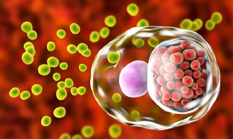 Bệnh Chlamydia có thể gây vô sinh