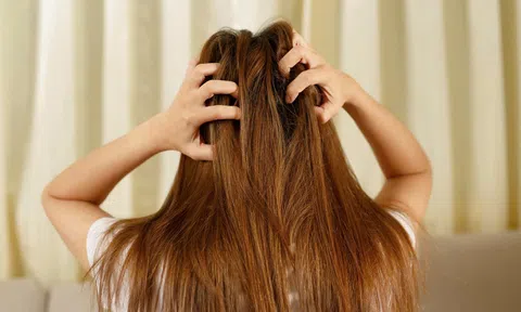 Bệnh viêm chân tóc - hãy đến Bảo Thanh Đường để điều trị dứt điểm