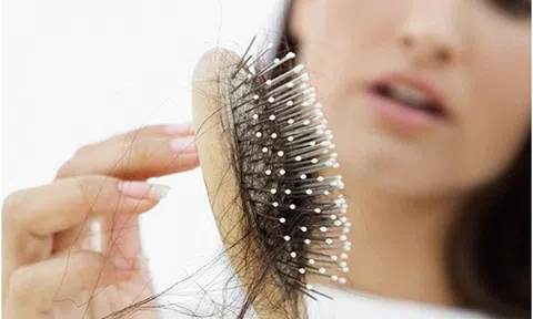 Rụng tóc sau sinh: Nguyên nhân và cách điều trị hiệu quả, nhanh chóng