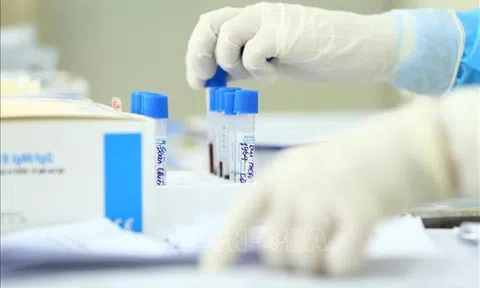 Trang thiết bị y tế, sinh phẩm xét nghiệm là mặt hàng phải kê khai giá