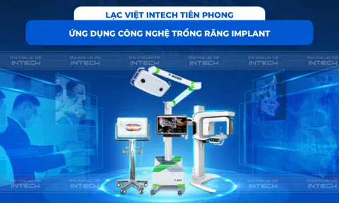 Bảng giá trồng răng Implant