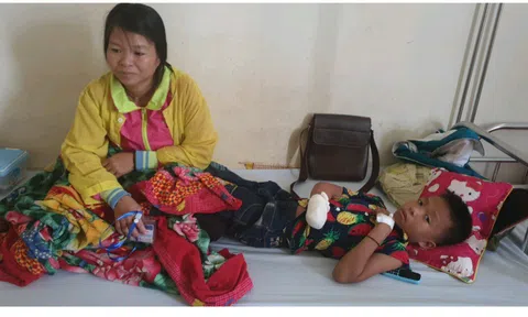 Thanh Hóa: Nát bàn tay do đèn pin loại đội đầu phát nổ