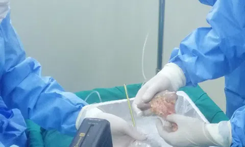Bệnh viện Đa khoa Thanh Hóa thực hiện ghép thận thành công từ bệnh nhân bị chết não
