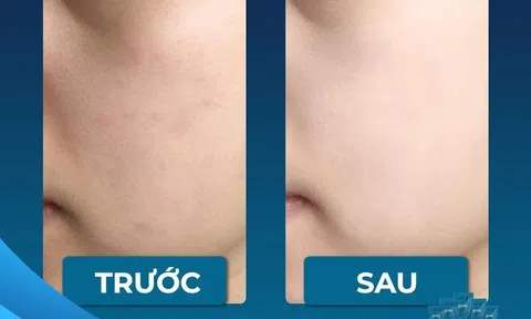 Biên tập viên nói gì về chất lượng của collagen cá tuyết Ona Global - Sản phẩm có thực sự tốt như lời đồn?