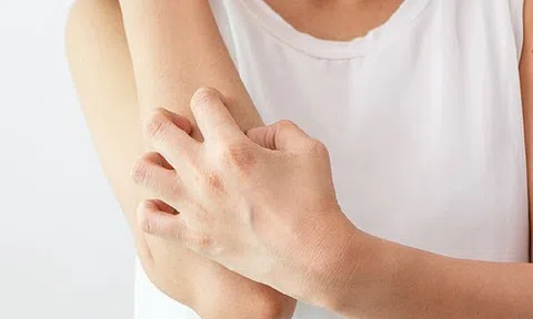 Trời trở lạnh đột ngột dễ gây ngứa ngoài da và nổi mề đay