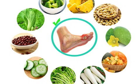 Những cách kiểm soát bệnh gút không cần thuốc