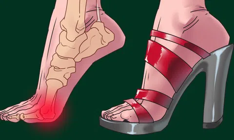 Trợ thủ đắc lực của phái đẹp: Lợi và bất lợi khi mang giày cao gót