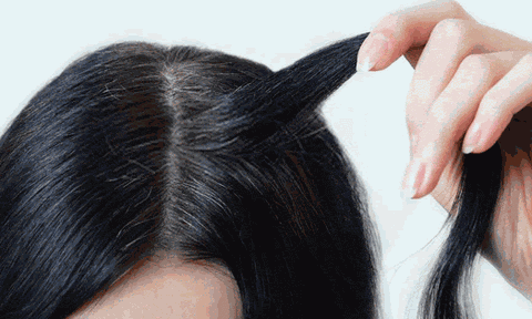 Bạc tóc sớm do gen di truyền có thể cải thiện được không?