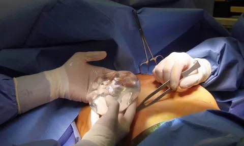 TP. Hồ Chí Minh: Lời khai của bác sĩ chở thi thể cô gái nâng ngực tử vong về Trà Vinh