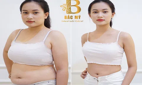 Thẩm mỹ viện quốc tế Bắc Mỹ giảm béo 1 lần lấy lại tuổi đôi mươi