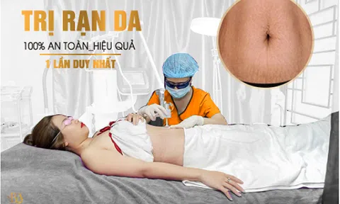 Chỉ 1 lần duy nhất xóa sạch 99% rạn da tại Thẩm Mỹ Viện Quốc Tế Bắc Âu