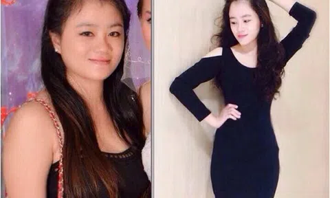 Thẩm mỹ viện quốc tế Bắc Mỹ giảm béo sau sinh một lần duy nhất