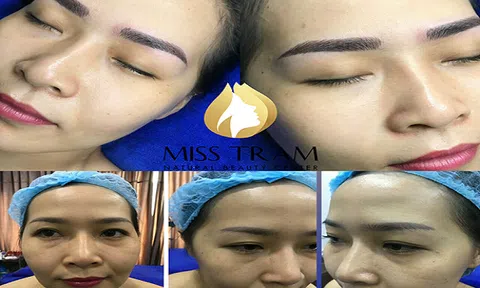 Ưu nhược điểm các phương pháp sửa chân mày phun xăm điêu khắc hỏng