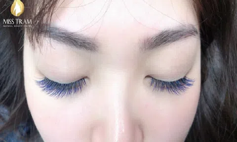 Các yếu tố tác động đến thời gian giữ mi nối