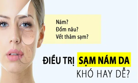 Thẩm mỹ viện quốc tế Bắc Mỹ điều trị nám tàn nhang bẩm sinh an toàn