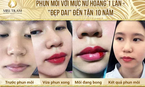 Ưu nhược điểm của các kỹ thuật phun môi: phun môi, điêu khắc môi