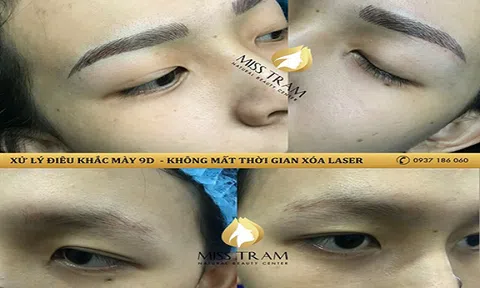 Cách khắc phục các lỗi phun xăm chân mày