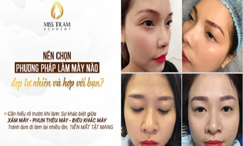 Ưu nhược điểm của các phương pháp thẩm mỹ làm đẹp chân mày