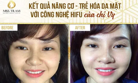 Thẩm mỹ viện chuyên làm trẻ hóa da an toàn tại TPHCM