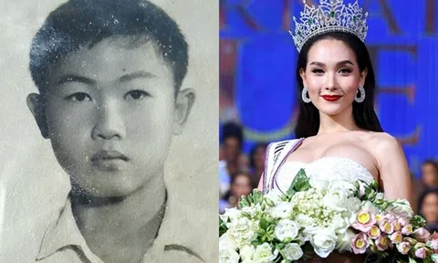 Tìm hiểu về nâng ngực chuyển giới