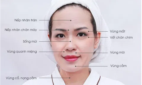 Nâng cơ trẻ hóa Ultherapii tại Thẩm mỹ viện Rose giúp Huyền My 'trẻ mãi không già'