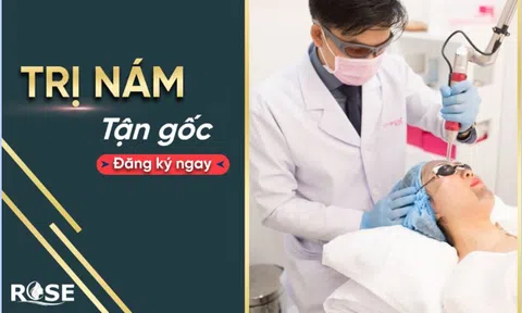 Thẩm mỹ viện Rose điều trị nám uy tín hiệu quả nhất Hà Nội