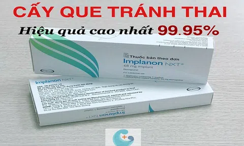 6 lý do chị em nên chọn cấy que tránh thai tại Phòng khám Sản phụ khoa chất lượng cao Vietmec Thanh Xuân