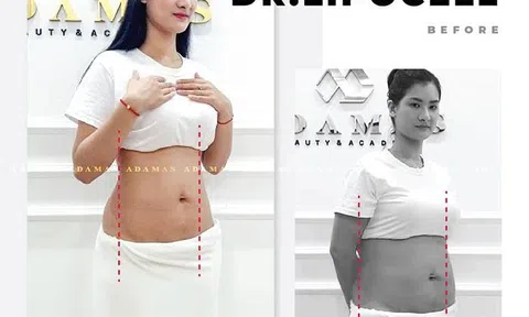 Những cách để giảm cân nguy hiểm nhất mọi thời đại